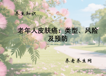 老年人皮肤癌：类型、风险及预防