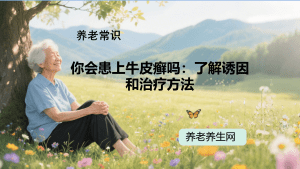 你会患上牛皮癣吗：了解诱因和治疗方法
