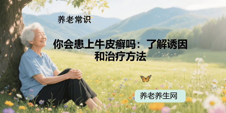 你会患上牛皮癣吗：了解诱因和治疗方法